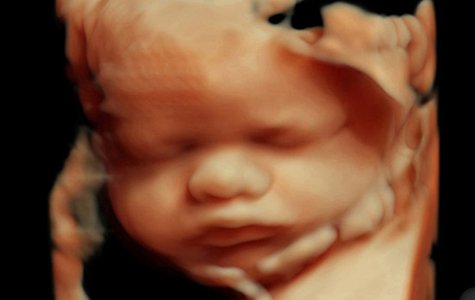 4D ultrasound of baby inside the womb