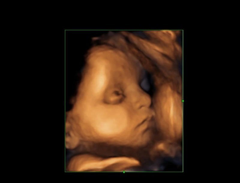 Getting a 3D/4D Ultrasound When You're Pregnant~ The Best ...